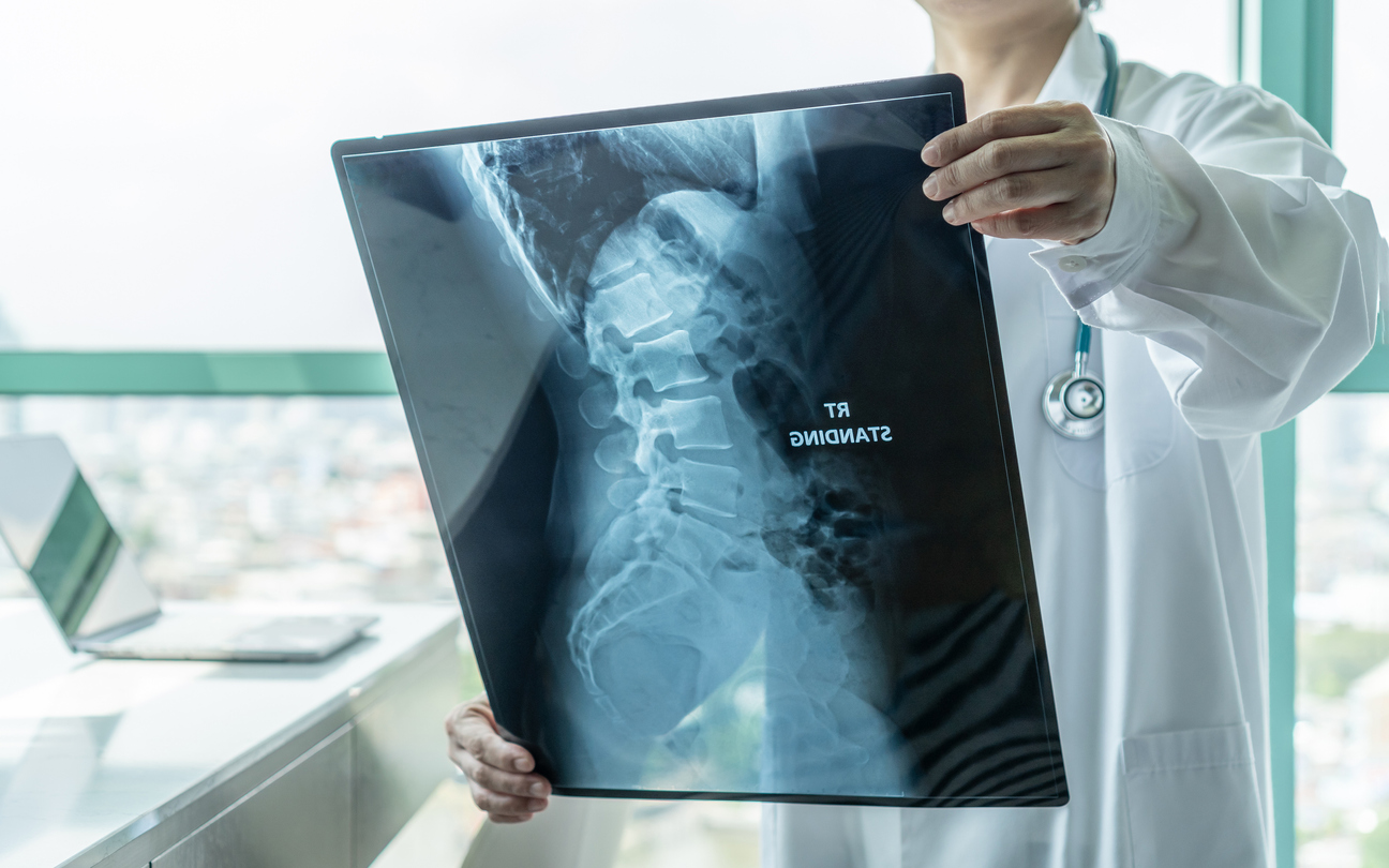 Many Accidents Can Cause Herniated Discs at C4/C5 or C5/C6. Here’s What You Need To Know.
