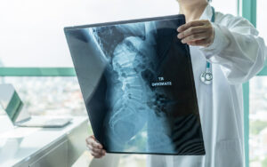 How Can Robles Babaee, Personal Injury Lawyers, Help Me After a Radiological Error in Santa Ana, California?