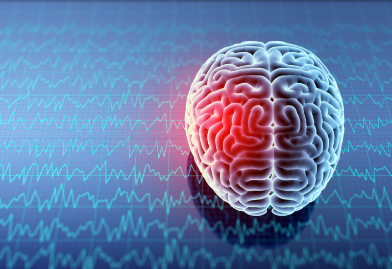 How to Know if You Have a Concussion from a Car Accident